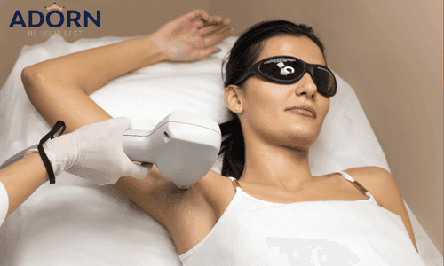 Hair Removal Treatment