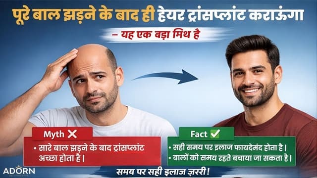 Hair transplant myths